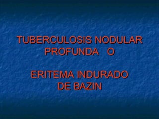 TUBERCULOSIS NODULARTUBERCULOSIS NODULAR
PROFUNDAPROFUNDA OO
ERITEMA INDURADOERITEMA INDURADO
DE BAZINDE BAZIN
 