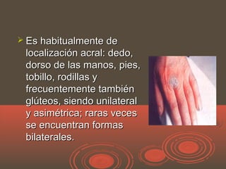  Es habitualmente deEs habitualmente de
localización acral: dedo,localización acral: dedo,
dorso de las manos, pies,dorso de las manos, pies,
tobillo, rodillas ytobillo, rodillas y
frecuentemente tambiénfrecuentemente también
glúteos, siendo unilateralglúteos, siendo unilateral
y asimétrica; raras vecesy asimétrica; raras veces
se encuentran formasse encuentran formas
bilaterales.bilaterales.
 