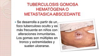 TUBERCULOSIS GOMOSA 
HEMATÓGENA O 
METASTASICA ABSCEDANTE 
 Se desarrolla a partir de un 
foco tuberculoso oculto y es 
más frecuente en niños con 
alteraciones inmunitarias. 
Los gomas son múltiples en 
tronco y extremidades y 
suelen ulcerarse. 
 