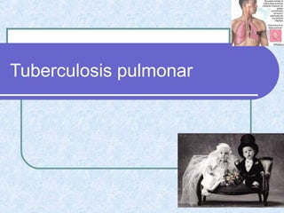 Tuberculosis pulmonar
 