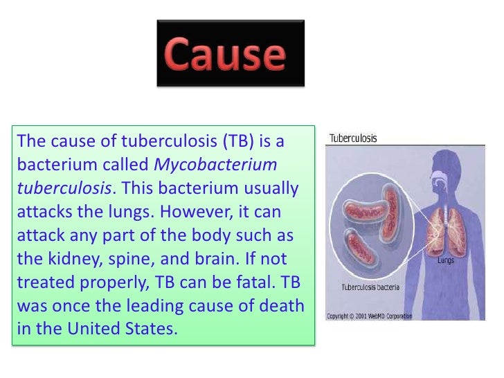Tuberculosis disease.docx
