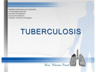 Tuberculosis Dra. Filerma Finol. 2013