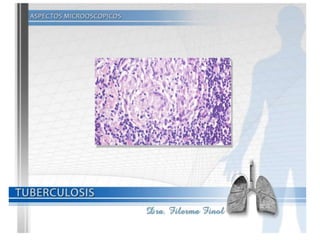 Tuberculosis Dra. Filerma Finol. 2013