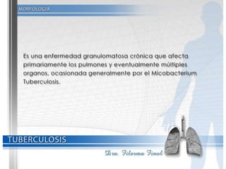 Tuberculosis Dra. Filerma Finol. 2013