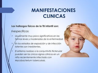 MANIFESTACIONES
CLINICAS
Los hallazgos físicos de la TB infantil son:
Inespecíficos:
 Usualmente muy poco significativos en las
formas leves y moderadas de la enfermedad.
 En los estadios de exposición y de infección
latentes son inexistentes.
 El eritema nodoso o la conjuntivitis flictenular
pueden ser los únicos signos clínicos en un
niño recientemente infectado con
Mycobacterium tuberculosis.
 