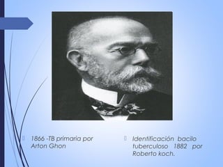  1866 -TB primaria por
Arton Ghon
 Identificación bacilo
tuberculoso 1882 por
Roberto koch.
 