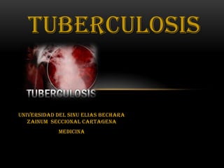 TUBERCULOSIS
UNIVERSIDAD DEL SINU ELIAS BECHARA
ZAINUM SECCIONAL CARTAGENA
MEDICINA
 