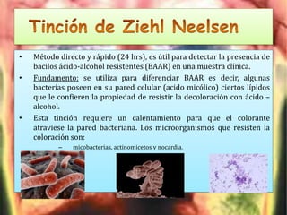 Tuberculosis (fil eminimizer)