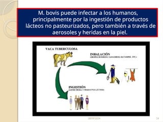 28/09/2024 24
M. bovis puede infectar a los humanos,
principalmente por la ingestión de productos
lácteos no pasteurizados, pero también a través de
aerosoles y heridas en la piel.
 
