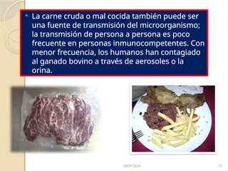 28/09/2024 25
 La carne cruda o mal cocida también puede ser
una fuente de transmisión del microorganismo;
la transmisión de persona a persona es poco
frecuente en personas inmunocompetentes. Con
menor frecuencia, los humanos han contagiado
al ganado bovino a través de aerosoles o la
orina.
 