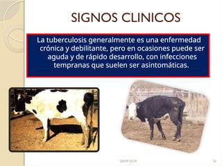 28/09/2024 26
SIGNOS CLINICOS
La tuberculosis generalmente es una enfermedad
crónica y debilitante, pero en ocasiones puede ser
aguda y de rápido desarrollo, con infecciones
tempranas que suelen ser asintomáticas.
 
