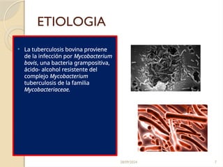 28/09/2024 7
ETIOLOGIA
 La tuberculosis bovina proviene
de la infección por Mycobacterium
bovis, una bacteria grampositiva,
ácido- alcohol resistente del
complejo Mycobacterium
tuberculosis de la familia
Mycobacteriaceae.
 