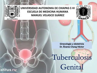 UNIVERSIDAD AUTONOMA DE CHIAPAS C-IV
ESCUELA DE MEDICINA HUMANA
MANUEL VELASCO SUÁREZ
 