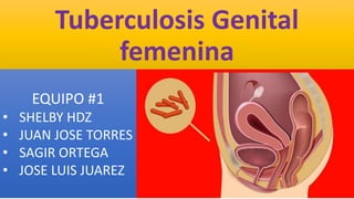 Tuberculosis Genital
femenina
EQUIPO #1
• SHELBY HDZ
• JUAN JOSE TORRES
• SAGIR ORTEGA
• JOSE LUIS JUAREZ
 