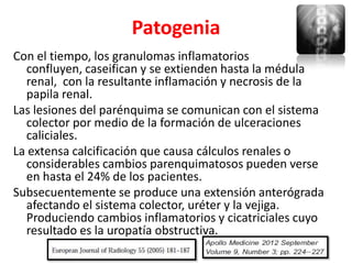 Patogenia
Con el tiempo, los granulomas inflamatorios
  confluyen, caseifican y se extienden hasta la médula
  renal, con la resultante inflamación y necrosis de la
  papila renal.
Las lesiones del parénquima se comunican con el sistema
  colector por medio de la formación de ulceraciones
  caliciales.
La extensa calcificación que causa cálculos renales o
  considerables cambios parenquimatosos pueden verse
  en hasta el 24% de los pacientes.
Subsecuentemente se produce una extensión anterógrada
  afectando el sistema colector, uréter y la vejiga.
  Produciendo cambios inflamatorios y cicatriciales cuyo
  resultado es la uropatía obstructiva.
 
