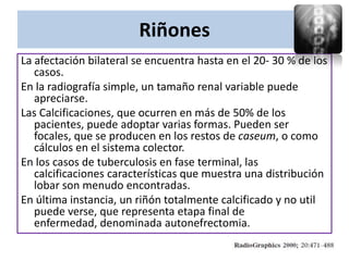 Riñones
La afectación bilateral se encuentra hasta en el 20- 30 % de los
   casos.
En la radiografía simple, un tamaño renal variable puede
   apreciarse.
Las Calcificaciones, que ocurren en más de 50% de los
   pacientes, puede adoptar varias formas. Pueden ser
   focales, que se producen en los restos de caseum, o como
   cálculos en el sistema colector.
En los casos de tuberculosis en fase terminal, las
   calcificaciones características que muestra una distribución
   lobar son menudo encontradas.
En última instancia, un riñón totalmente calcificado y no util
   puede verse, que representa etapa final de
   enfermedad, denominada autonefrectomia.
 