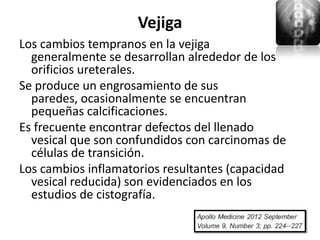 Vejiga
Los cambios tempranos en la vejiga
  generalmente se desarrollan alrededor de los
  orificios ureterales.
Se produce un engrosamiento de sus
  paredes, ocasionalmente se encuentran
  pequeñas calcificaciones.
Es frecuente encontrar defectos del llenado
  vesical que son confundidos con carcinomas de
  células de transición.
Los cambios inflamatorios resultantes (capacidad
  vesical reducida) son evidenciados en los
  estudios de cistografía.
 