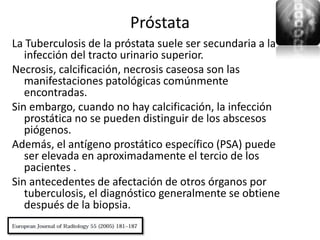 Próstata
La Tuberculosis de la próstata suele ser secundaria a la
   infección del tracto urinario superior.
Necrosis, calcificación, necrosis caseosa son las
   manifestaciones patológicas comúnmente
   encontradas.
Sin embargo, cuando no hay calcificación, la infección
   prostática no se pueden distinguir de los abscesos
   piógenos.
Además, el antígeno prostático específico (PSA) puede
   ser elevada en aproximadamente el tercio de los
   pacientes .
Sin antecedentes de afectación de otros órganos por
   tuberculosis, el diagnóstico generalmente se obtiene
   después de la biopsia.
 