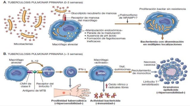 Resultado de imagen para fisiopatologia tbc en niños