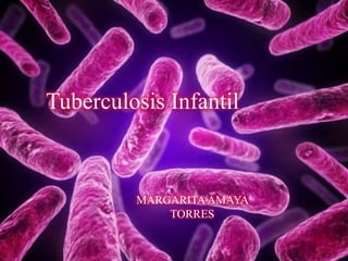 Tuberculosis Infantil
MARGARITA AMAYA
TORRES
 