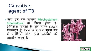 Tuberculosis in hindi tb | PPTX