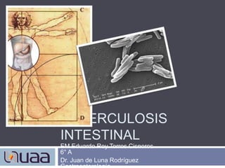 Tuberculosis intestinal EM Eduardo Rey Torres Cisneros 			       6° A Dr. Juan de Luna Rodríguez                           Gastroenterología 