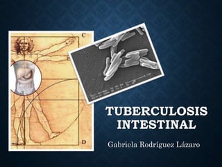 TUBERCULOSIS
INTESTINAL
Gabriela Rodríguez Lázaro
 