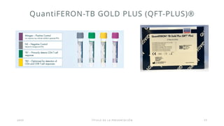 Tuberculosis latente.................... | PPTX