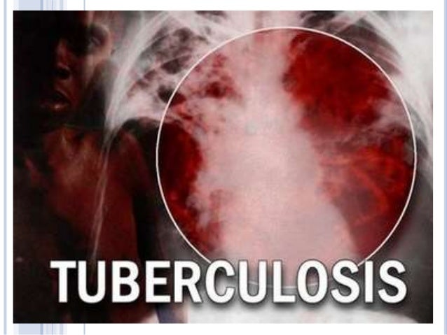 Microbiologia ambiental Microbiologia ambiental