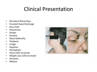 Clinical Presentation
• Persistent Rhinorrhea
• Purulent Nasal Discharge
• Sinus Pain
• Hoarseness
• Stridor
• Earache
• Nasal Deformity
• Proptosis
• Cough
• Dyspnea
• Hemoptysis
• Fever (23% at onset)
• Weight Loss (15% at onset)
• Anorexia
• Malaise
 
