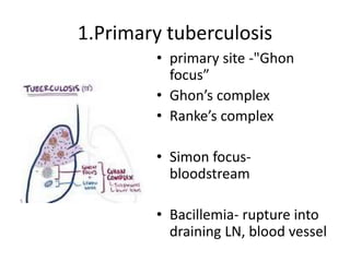 1.Primary tuberculosis
• primary site -"Ghon
focus”
• Ghon’s complex
• Ranke’s complex
• Simon focus-
bloodstream
• Bacillemia- rupture into
draining LN, blood vessel
 