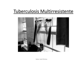 Tuberculosis Multirresistente




          Autor: José Chirinos
 
