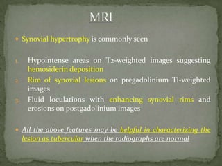  Synovial hypertrophy is commonly seen
1. Hypointense areas on T2-weighted images suggesting
hemosiderin deposition
2. Rim of synovial lesions on pregadolinium Tl-weighted
images
3. Fluid loculations with enhancing synovial rims and
erosions on postgadolinium images
 All the above features may be helpful in characterizing the
lesion as tubercular when the radiographs are normal
 