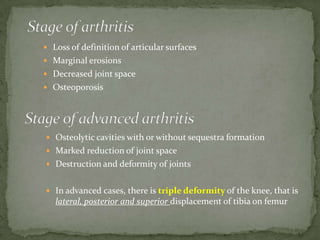  Loss of definition of articular surfaces
 Marginal erosions
 Decreased joint space
 Osteoporosis
 Osteolytic cavities with or without sequestra formation
 Marked reduction of joint space
 Destruction and deformity of joints
 In advanced cases, there is triple deformity of the knee, that is
lateral, posterior and superior displacement of tibia on femur
 