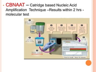 Cbnaat Form.pdf Tuberculosis of genital tract presentation | PPTX