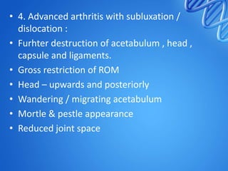 • 4. Advanced arthritis with subluxation /
dislocation :
• Furhter destruction of acetabulum , head ,
capsule and ligaments.
• Gross restriction of ROM
• Head – upwards and posteriorly
• Wandering / migrating acetabulum
• Mortle & pestle appearance
• Reduced joint space

 