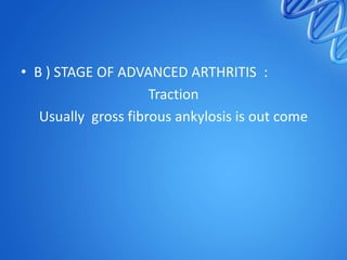 • B ) STAGE OF ADVANCED ARTHRITIS :
Traction
Usually gross fibrous ankylosis is out come

 