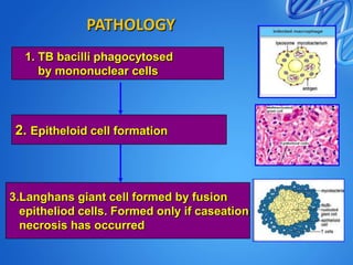 PATHOLOGY
1. TB bacilli phagocytosed
by mononuclear cells

2. Epitheloid cell formation

3.Langhans giant cell formed by fusion
epitheliod cells. Formed only if caseation
necrosis has occurred

 