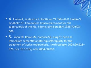 • 4.

Eskola A, Santavirta S, Konttinen YT, Tallroth K, Hoikka V,
Lindholm ST. Cementless total replacement for old
tuberculosis of the hip. J Bone Joint Surg (Br) 1988;70:603–
606.

• 5.

Yoon TR, Rowe SM, Santosa SB, Jung ST, Seon JK.
Immediate cementless total hip arthroplasty for the
treatment of active tuberculosis. J Arthroplasty. 2005;20:923–
926. doi: 10.1016/j.arth.2004.08.002.

 