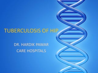 TUBERCULOSIS OF HIP
DR. HARDIK PAWAR
CARE HOSPITALS

 