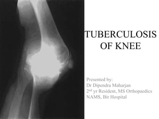TUBERCULOSIS
OF KNEE
Presented by:
Dr Dipendra Maharjan
2nd yr Resident, MS Orthopaedics
NAMS, Bir Hospital
 