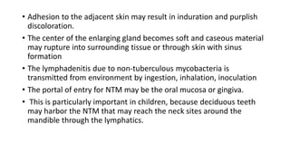 • Adhesion to the adjacent skin may result in induration and purplish
discoloration.
• The center of the enlarging gland becomes soft and caseous material
may rupture into surrounding tissue or through skin with sinus
formation
• The lymphadenitis due to non-tuberculous mycobacteria is
transmitted from environment by ingestion, inhalation, inoculation
• The portal of entry for NTM may be the oral mucosa or gingiva.
• This is particularly important in children, because deciduous teeth
may harbor the NTM that may reach the neck sites around the
mandible through the lymphatics.
 