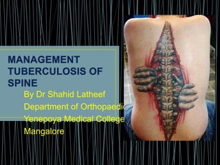 By Dr Shahid Latheef
Department of Orthopaedics
Yenepoya Medical College
Mangalore
 