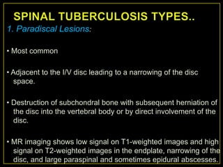 1. Paradiscal Lesions:

• Most common

• Adjacent to the I/V disc leading to a narrowing of the disc
   space.

• Destruction of subchondral bone with subsequent herniation of
  the disc into the vertebral body or by direct involvement of the
  disc.

• MR imaging shows low signal on T1-weighted images and high
  signal on T2-weighted images in the endplate, narrowing of the
  disc, and large paraspinal and sometimes epidural abscesses.
 