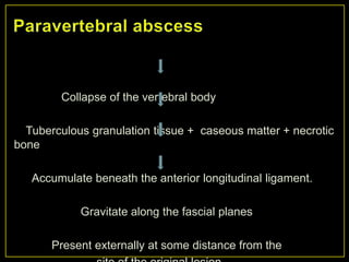 Collapse of the vertebral body

  Tuberculous granulation tissue + caseous matter + necrotic
bone

   Accumulate beneath the anterior longitudinal ligament.

            Gravitate along the fascial planes

       Present externally at some distance from the
 