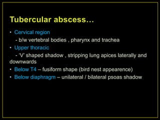 • Cervical region
  - b/w vertebral bodies , pharynx and trachea
• Upper thoracic
  - „V‟ shaped shadow , stripping lung apices laterally and
downwards
• Below T4 – fusiform shape (bird nest appearence)
• Below diaphragm – unilateral / bilateral psoas shadow
 