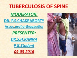 TUBERCULOSIS OF SPINE
MODERATOR:
DR. P.S.CHAKRABORTY
Assoc.prof.orthopaedics
PRESENTER:
DR.S.H.RANNA
P.G.Student
09-03-2016
 