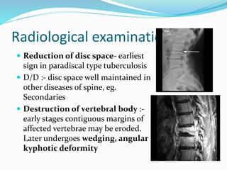 TUBERCULOSIS OF SPINE.pptx