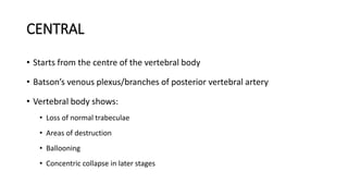 TUBERCULOSIS OF THE SPINE AND MANAGEMENT | PPT