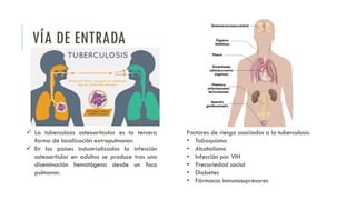 Tuberculosis sea PDF